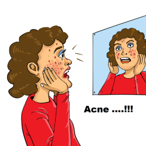 What is acne-1